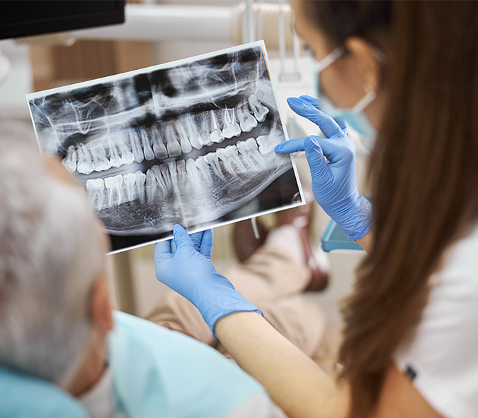 Texas Super Smiles for Kids | Periodontal Treatment, Extractions and Root Canals